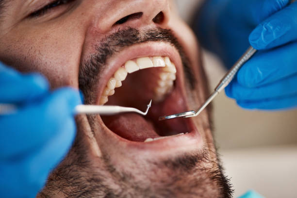Best Emergency Cosmetic Dentistry (e.g., broken veneers) in River Park, FL